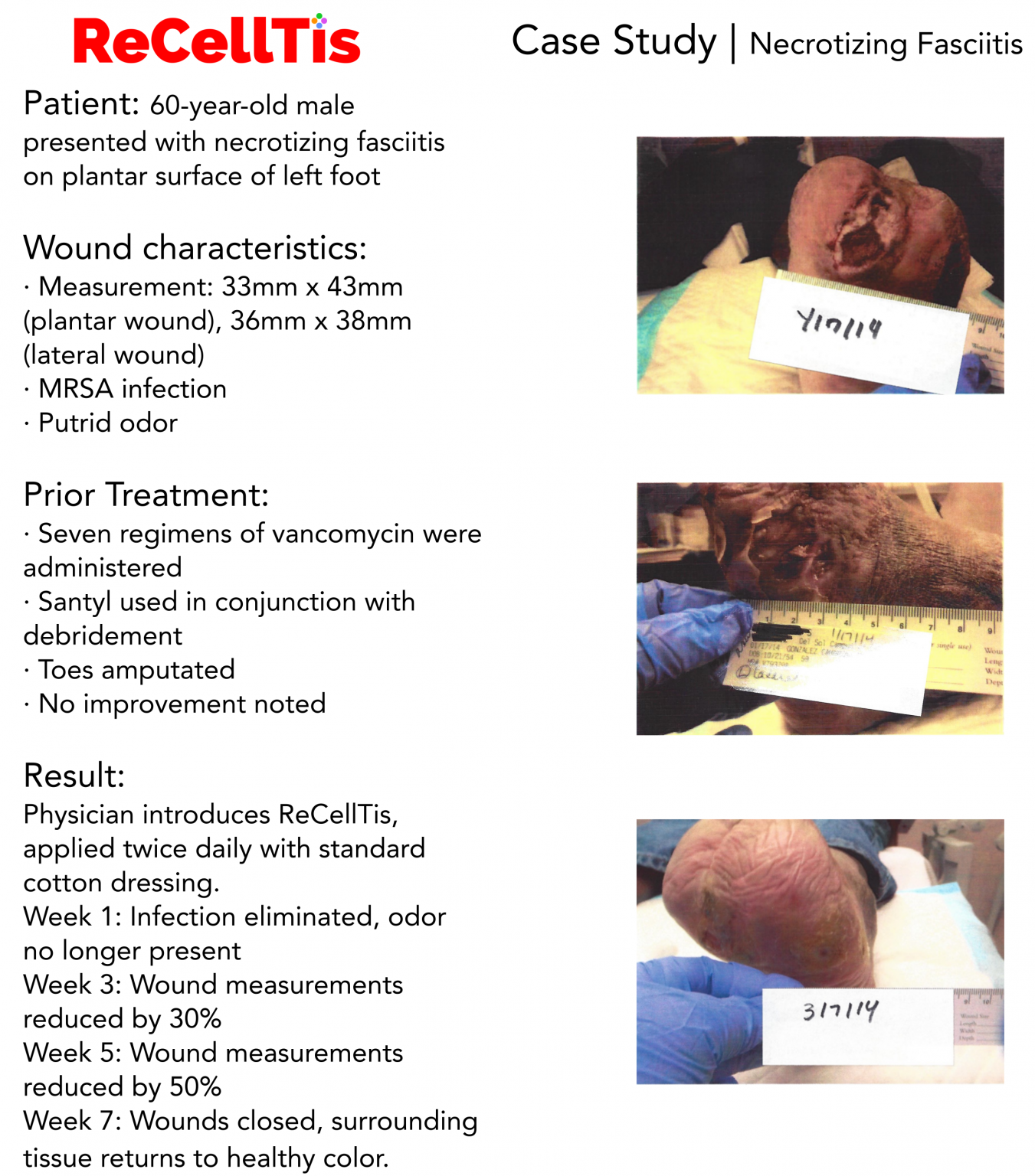 recelltis case study